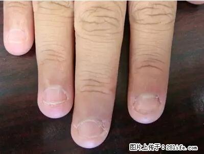 剪指甲、挖耳屎，这些日常小动作竟隐藏大危害！ - 西双版纳生活资讯 - 西双版纳28生活网 bn.28life.net